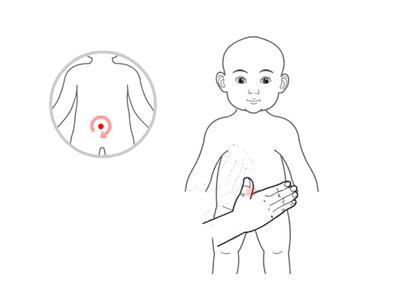 小兒推拿治療感冒嗎？